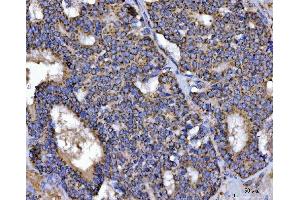 IHC analysis of TFEB using anti-TFEB antibody (ABIN7600648). (TFEB antibody  (AA 214-326))