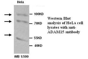 Image no. 1 for anti-ADAM Metallopeptidase Domain 15 (ADAM15) antibody (ABIN1574458)