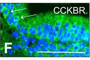 Homogenous, granular expression of CCKBR is seen within the neuroepithelial cells, with intense perinuclear labelling.