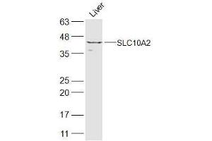 Mouse liver lysate probed with SLC10A2 Polyclonal Antibody  at 1:300 overnight at 4˚C. (SLC10A2 antibody  (AA 131-230))