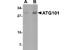 Western Blotting (WB) image for anti-Chromosome 12 Open Reading Frame 44 (C12orf44) (Middle Region) antibody (ABIN1030867)