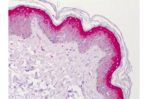 Human Skin: Formalin-Fixed, Paraffin-Embedded (FFPE) (STEAP4 antibody)