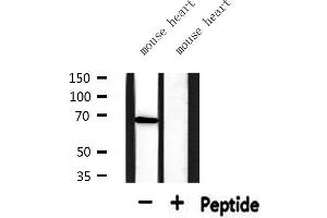 Western blot analysis of extracts from mouse heart, using PIAS3 Antibody. (PIAS3 antibody  (N-Term))