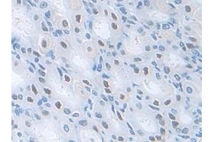 Immunohistochemistry (IHC) image for anti-Pyridoxal Kinase (PDXK) (AA 29-285) antibody (ABIN7441904)