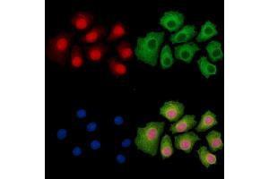 anti-URB2 Ribosome Biogenesis 2 Homolog (URB2) antibody