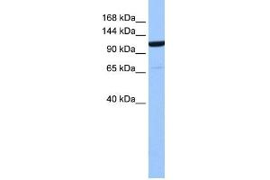 WB Suggested Anti-NUP155 Antibody Titration: 0. (NUP155 antibody  (Middle Region))