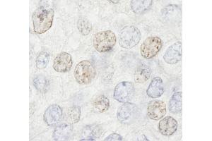 Immunohistochemistry (IHC) image for anti-Histone Deacetylase 7 (HDAC7) (AA 902-952) antibody (ABIN7448594) (HDAC7 antibody  (AA 902-952))