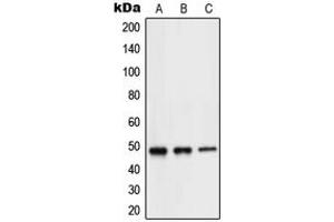 Western blot analysis of NEUROD2 expression in Jurkat (A), mouse brain (B), rat brain (C) whole cell lysates. (NEUROD2 antibody  (Center))