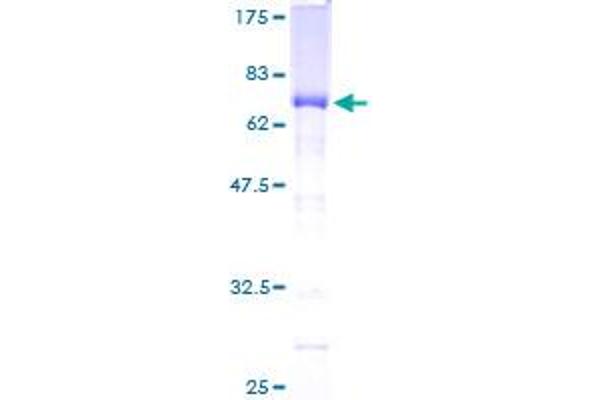 MEIS2 Protein (AA 1-381) (GST tag)