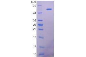 Image no. 1 for 5'-Nucleotidase, Ecto (CD73) (NT5E) (AA 29-500) (Active) protein (His tag) (ABIN6239910) (CD73 Protein (AA 29-500) (His tag))