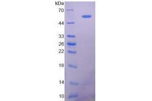 Image no. 1 for 5'-Nucleotidase, Ecto (CD73) (NT5E) (AA 29-500) (Active) protein (His tag) (ABIN5665756)