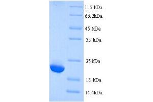 SDS-PAGE (SDS) image for Immunoglobulin lambda-Like Polypeptide 5 (IGLL5) (AA 36-214) protein (His tag) (ABIN4974628) (IGLL5 Protein (AA 36-214) (His tag))