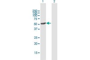 Western Blot analysis of IFI44 expression in transfected 293T cell line by IFI44 MaxPab polyclonal antibody. (IFI44 antibody  (AA 1-444))