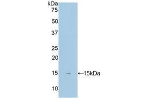 Detection of Recombinant S100B, Human using Polyclonal Antibody to S100 Calcium Binding Protein B (S100B) (S100B antibody  (AA 1-92))