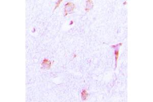 Immunohistochemical analysis of Cathepsin E staining in human brain formalin fixed paraffin embedded tissue section. (Cathepsin E antibody  (Center))