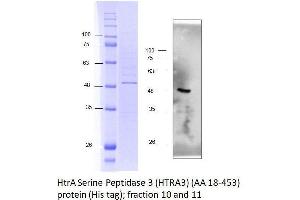 Western Blotting (WB) image for HtrA Serine Peptidase 3 (HTRA3) (AA 18-453) protein (His tag) (ABIN3092994) (HTRA3 Protein (AA 18-453) (His tag))