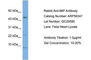 WB Suggested Anti-MIF  Antibody Titration: 0. (MIF antibody  (Middle Region))