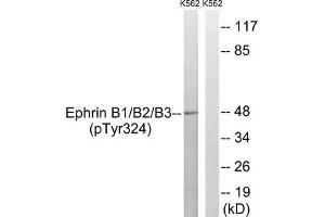 Western blot analysis of extracts from K562 cells treated with serum using Ephrin B1/B2/B3 (Phospho-Tyr324) Antibody. (EFNB1/EFNB2/EFNB3 (pTyr324) antibody)