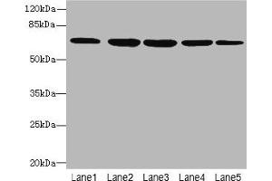 Western blot All lanes: ILVBL antibody at 4 μg/mL Lane 1: HepG2 whole cell lysate Lane 2: Hela whole cell lysate Lane 3: A549 whole cell lysate Lane 4: Jurkat whole cell lysate Lane 5: U87 whole cell lysate Secondary Goat polyclonal to rabbit IgG at 1/10000 dilution Predicted band size: 68 kDa Observed band size: 68 kDa