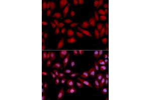 Immunofluorescence analysis of U2OS cells using PSMA2 antibody.
