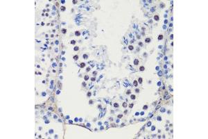 Immunohistochemistry of paraffin-embedded mouse testis using CDKN1B/p27KIP1 antibody (ABIN7266603) at dilution of 1:100 (40x lens). (CDKN1B antibody  (AA 1-100))