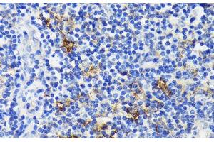 Immunohistochemistry of paraffin-embedded Human tonsil using TREM2 Polyclonal Antibody at dilution of 1:200 (40x lens). (TREM2 antibody)