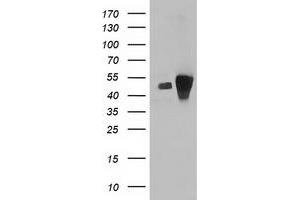 HEK293T cells were transfected with the pCMV6-ENTRY control (Left lane) or pCMV6-ENTRY ARFGAP1 (Right lane) cDNA for 48 hrs and lysed. (ARFGAP1 antibody)