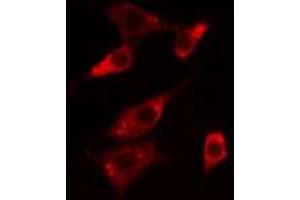 ABIN6276064 staining  Hela cells by IF/ICC. (NTSR1 antibody  (Internal Region))