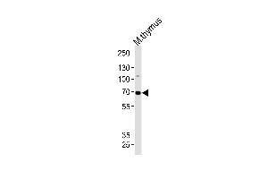 Western blot analysis of lysate from mouse thymus tissue lysate, using Mouse Ephb6 Antibody (Center) (ABIN1881301 and ABIN2838401).