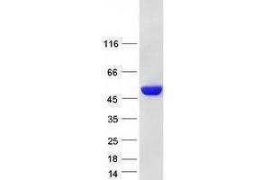 Western Blotting (WB) image for Glucose-6-Phosphate Dehydrogenase (G6PD) (Transcript Variant 2) protein (Myc-DYKDDDDK Tag) (ABIN2721522)
