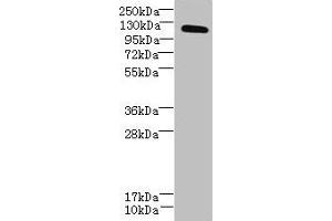 Western blot All lanes: DIS3L antibody at 6 μg/mL + MCF-7 whole cell lysate Secondary Goat polyclonal to rabbit IgG at 1/10000 dilution Predicted band size: 121, 106, 87, 112 kDa Observed band size: 121 kDa