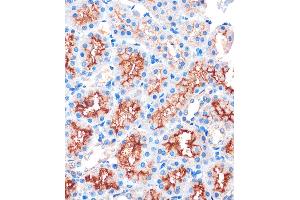Immunohistochemistry of paraffin-embedded Rat kidney using IQG Rabbit pAb (ABIN7268022) at dilution of 1:100 (40x lens). (IQGAP2 antibody  (AA 1330-1440))