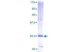Image no. 1 for Ubiquitin-Conjugating Enzyme E2Q Family Member 1 (UBE2Q1) (AA 1-71) protein (GST tag) (ABIN1324396) (UBE2Q1 Protein (AA 1-71) (GST tag))
