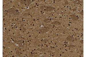 ABIN6278641 at 1/100 staining Rat brain tissue by IHC-P. (T-Box 15/18 antibody)