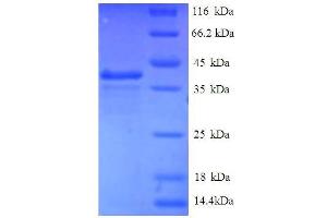 EIF1 Protein (AA 1-113, full length) (GST tag)