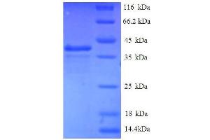 Eukaryotic Translation Initiation Factor 1 (EIF1) (AA 1-113), (full length) protein (GST tag) (EIF1 Protein (AA 1-113, full length) (GST tag))