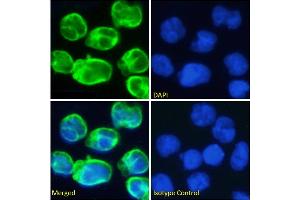 Immunofluorescence staining of fixed Molt4 cells with anti-CD3 epsilon antibody OKT-3. (Recombinant CD3E (Muromonab Biosimilar) antibody)
