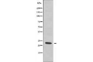 Western blot analysis of extracts from COLO205 cells, using RPS5 antibody. (RPS5 antibody  (Internal Region))