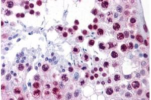 Human Testis: Formalin-Fixed, Paraffin-Embedded (FFPE) (HMGB1 antibody  (AA 1-91))