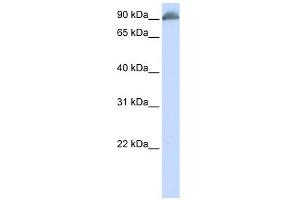 EPB41 antibody used at 1 ug/ml to detect target protein. (EPB41 antibody  (N-Term))
