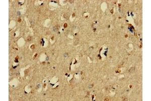 Immunohistochemistry of paraffin-embedded human brain tissue using ABIN7171209 at dilution of 1:100 (SNCAIP antibody  (AA 309-553))