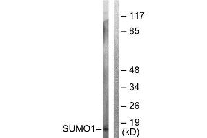 Western Blotting (WB) image for anti-Small Ubiquitin Related Modifier Protein 1 (SUMO1) (N-Term) antibody (ABIN1848853) (SUMO1 antibody  (N-Term))