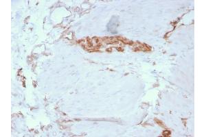 Formalin-fixed, paraffin-embedded human Colon stained with Fodrin Mouse Monoclonal Antibody (SPTAN1/3351). (SPTAN1 antibody  (AA 2351-2475))