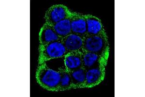 Confocal immunofluorescent analysis of CLCN7 Antibody (C-term) (ABIN655808 and ABIN2845235) with WiDr cell followed by Alexa Fluor 488-conjugated goat anti-rabbit lgG (green). (CLCN7 antibody  (C-Term))