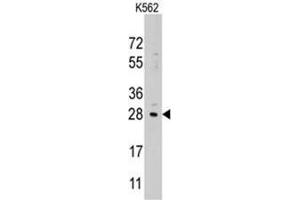 Image no. 1 for anti-Lin-28 Homolog B (LIN28B) (Center) antibody (ABIN357013) (LIN28B antibody  (Center))