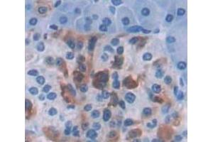 IHC-P analysis of Human Tissue, with DAB staining. (IRF1 antibody  (AA 11-276))