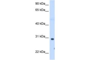 Western Blotting (WB) image for anti-ST3 beta-Galactoside alpha-2,3-Sialyltransferase 3 (ST3GAL3) antibody (ABIN2463000) (ST3GAL3 antibody)