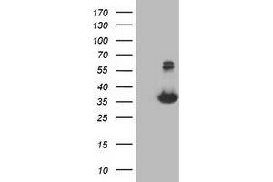 HEK293T cells were transfected with the pCMV6-ENTRY control (Left lane) or pCMV6-ENTRY MGLL (Right lane) cDNA for 48 hrs and lysed. (MGLL antibody)