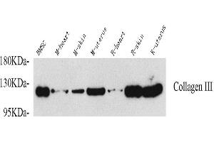Western Blot analysis of various samples using COL3A1 Polyclonal Antibody at dilution of 1:750. (COL3A1 antibody)