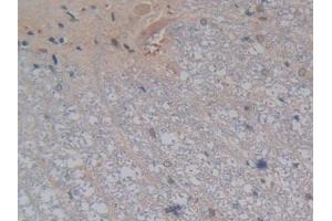 DAB staining on IHC-P; Samples: Rat Spinal cord Tissue (Kallikrein 4 antibody  (AA 32-256))